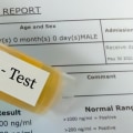 Will CBD Show Up on a Drug Test?
